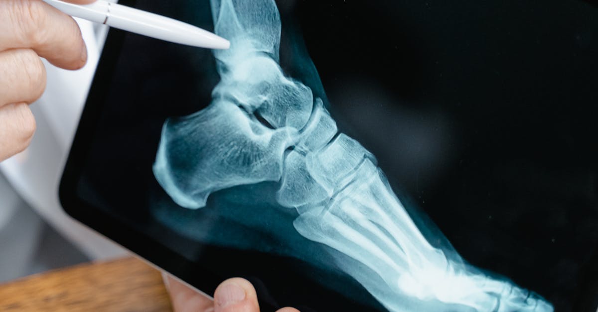 The Role of Physiotherapy in Podiatric Pain Relief